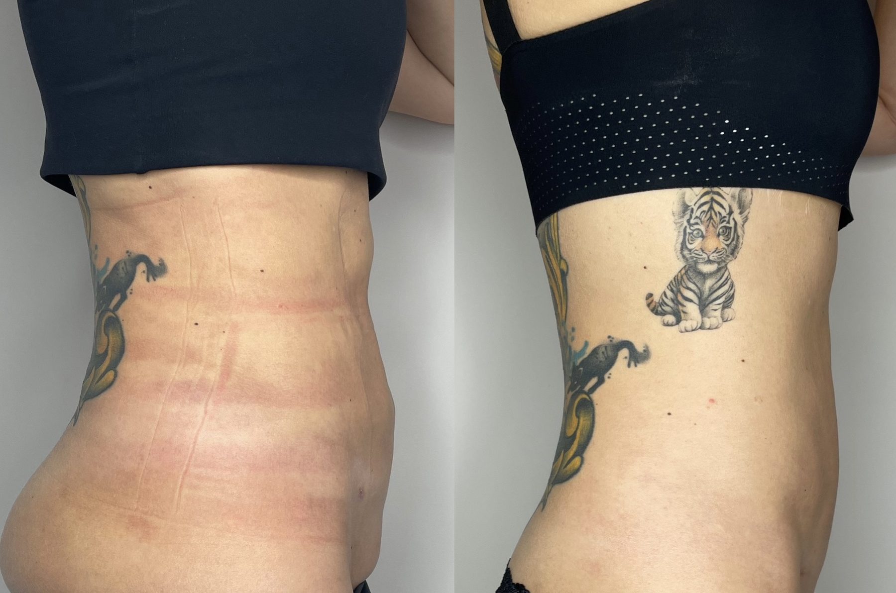 LPG Endermologie Bad Homburg - Praxis D.