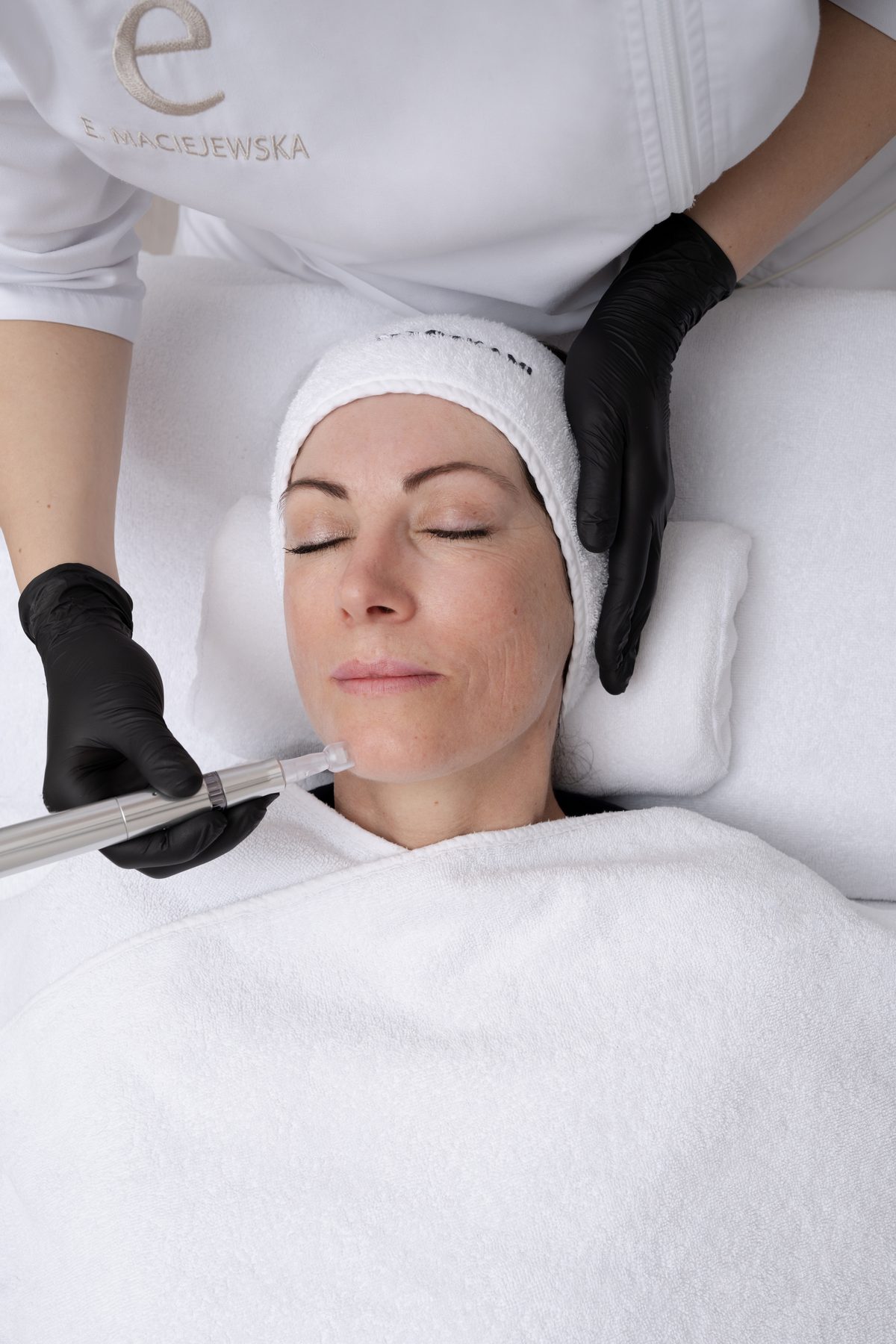 RF-Microneedling in Bad Homburg - Praxis D.